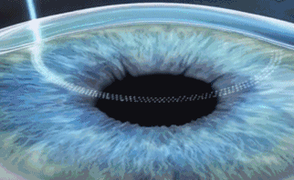 1602491491156818.gif 2.gif