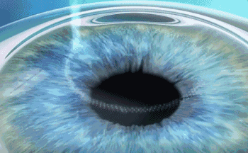 1602491769935381.gif 3.gif