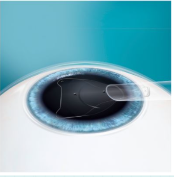 友华普惠眼科 友华普惠眼科