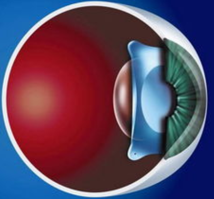 友华普惠眼科ICL 友华普惠眼科ICL