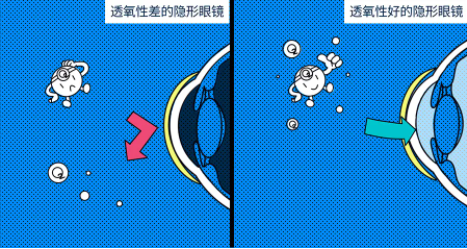 隐形眼镜注意事项 隐形眼镜注意事项