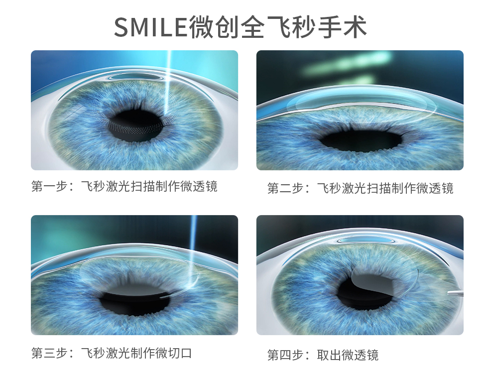 1639810174465936.jpg 全飞秒.jpg